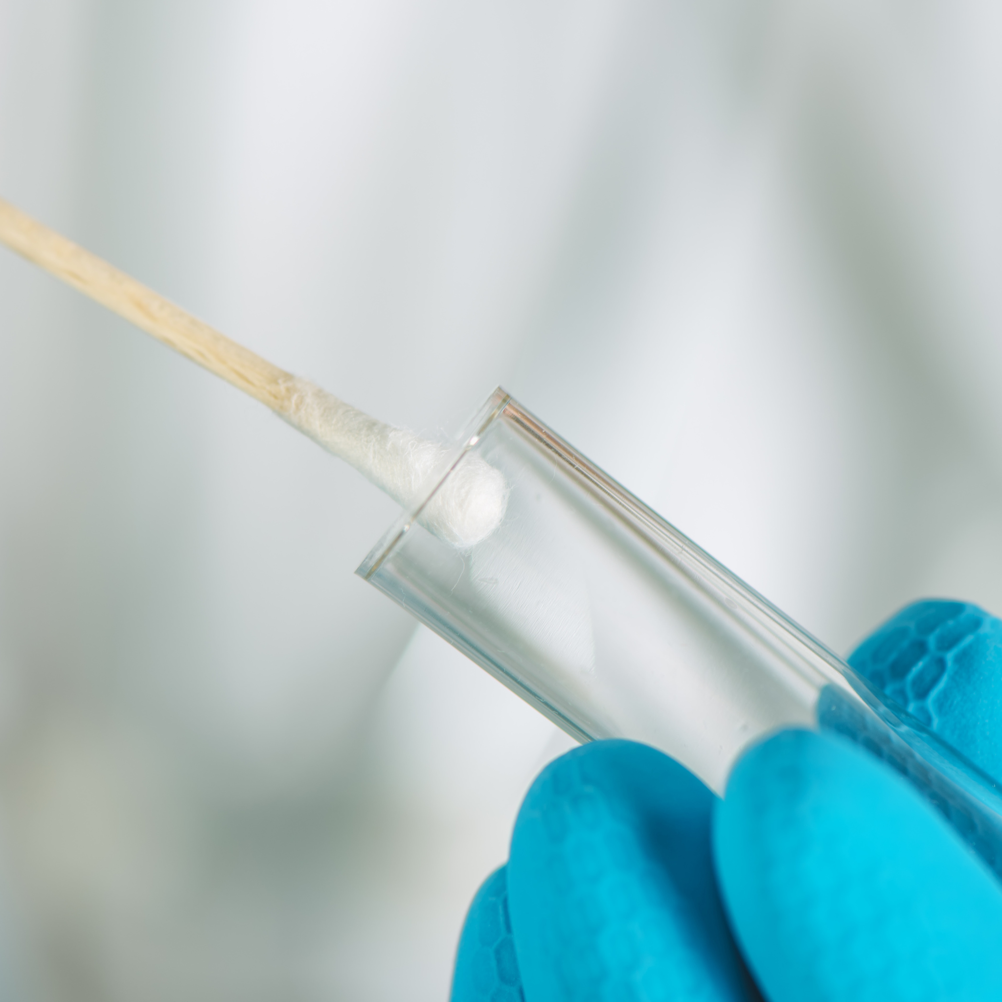 Cortisol Awakening Response