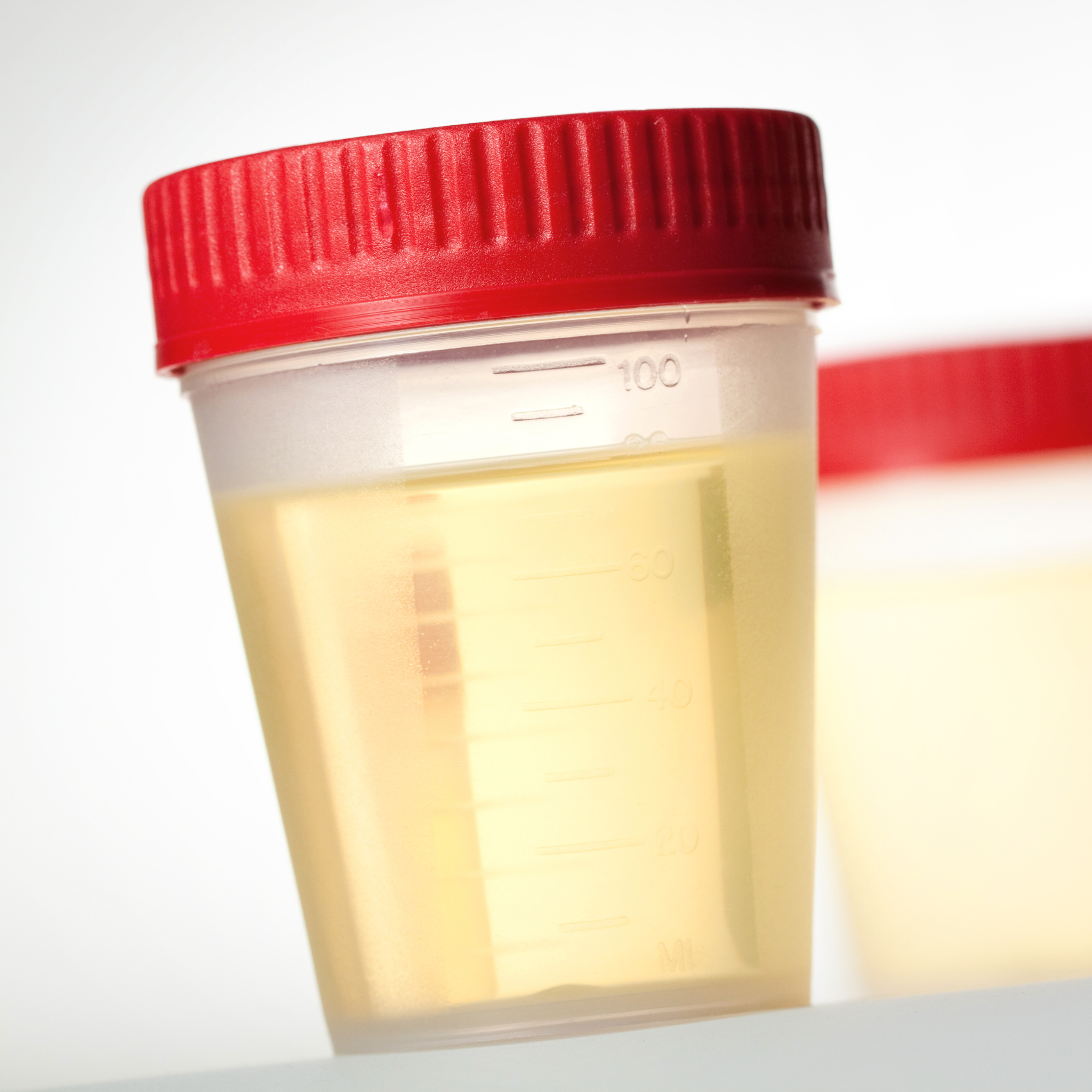 Estrogen Elite Dried Urine