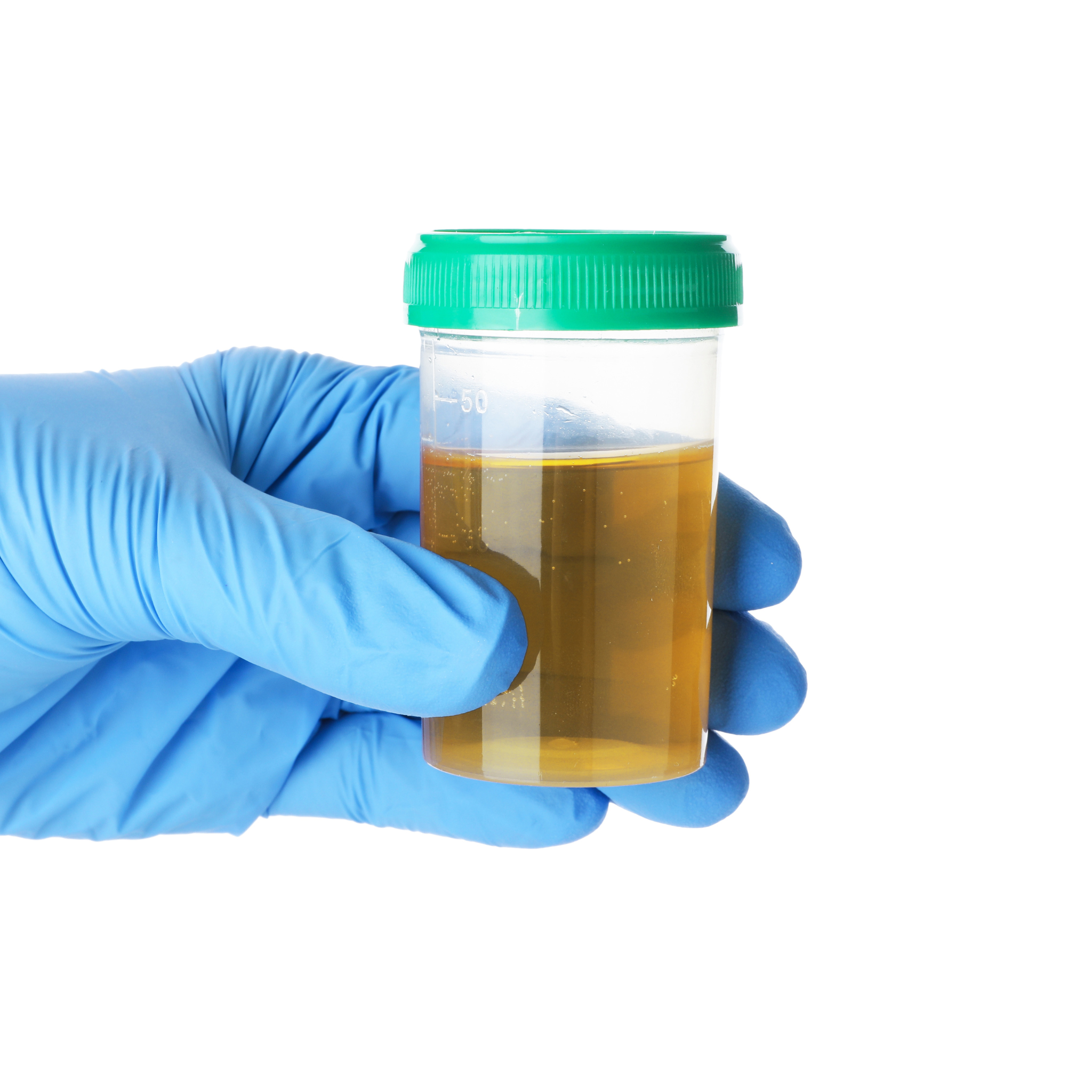 Iodine Loading Test