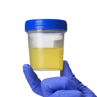 Iodine Random
