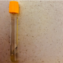Single Serum Hormone