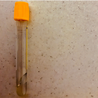 Single Serum Hormone